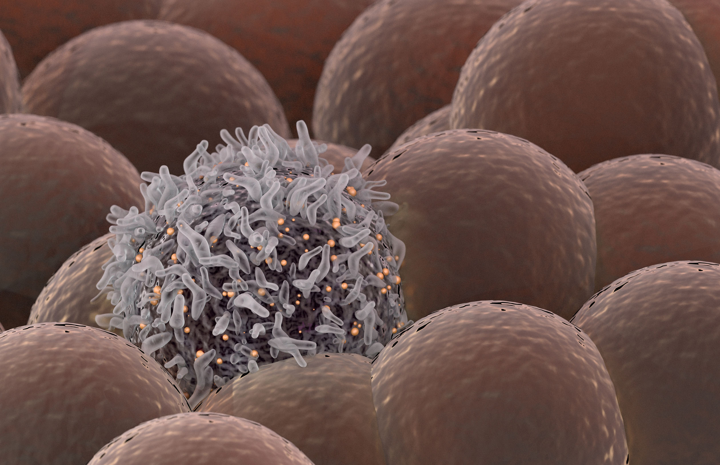 Cancer cell among healthy cells