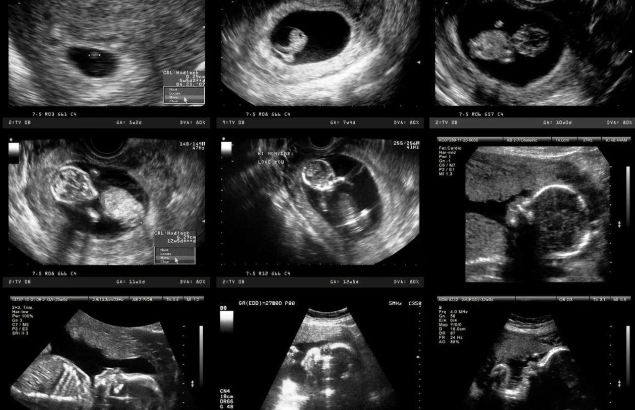 Womb courtesy GETTY Images