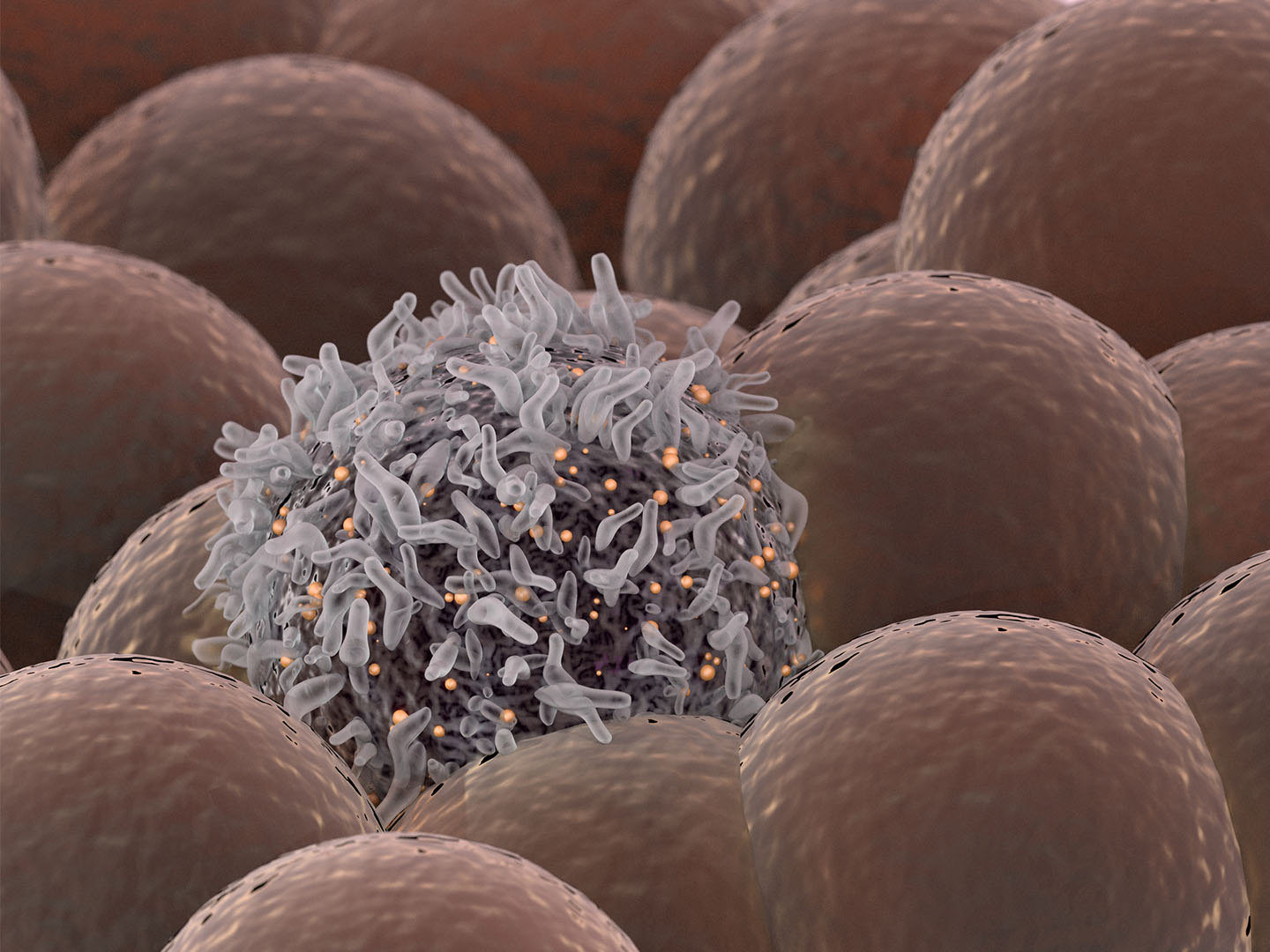 Cancer cell among healthy cells