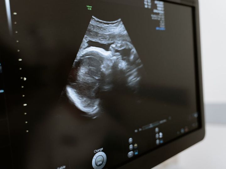 In utero ultrasound