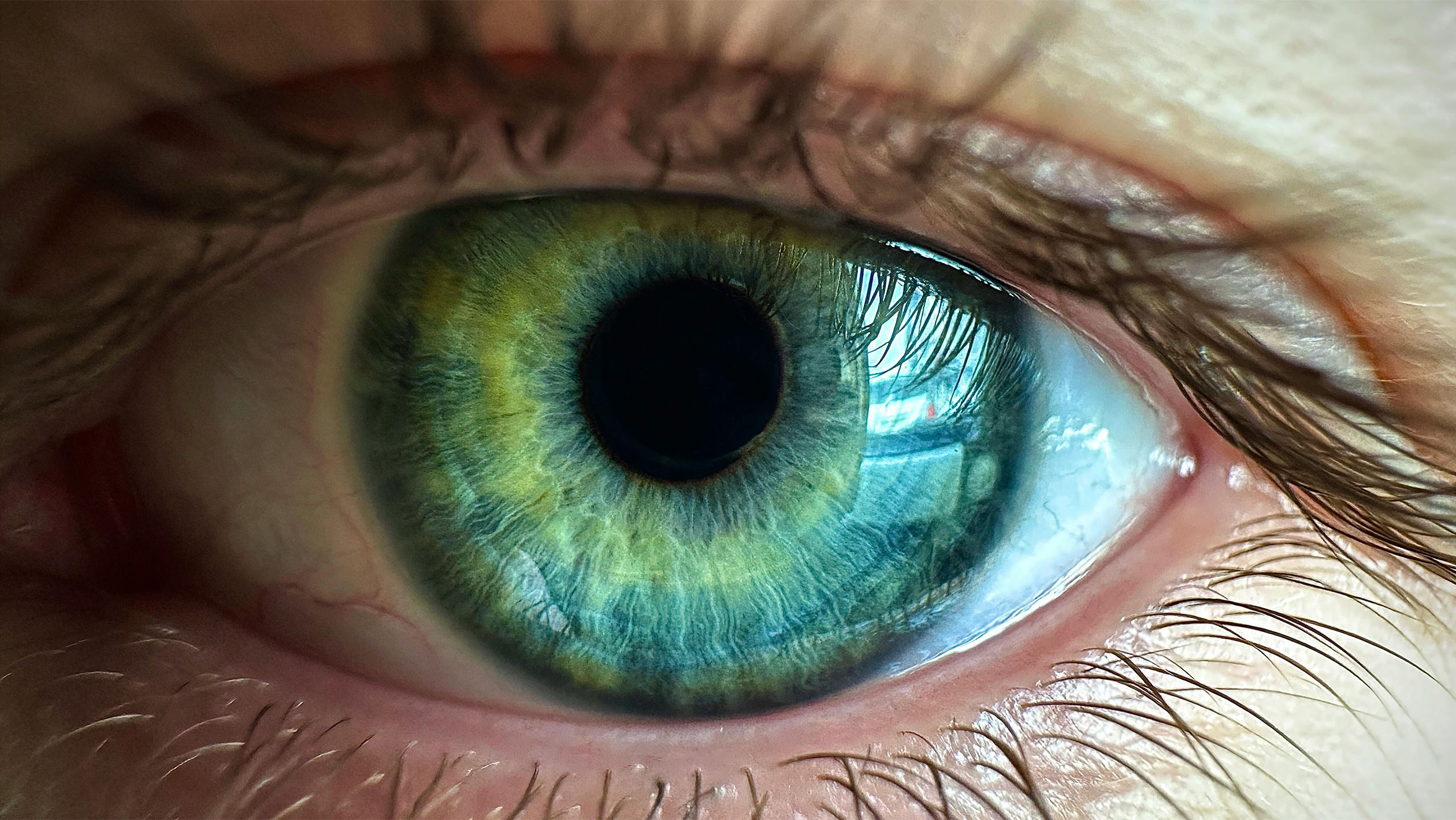 eye