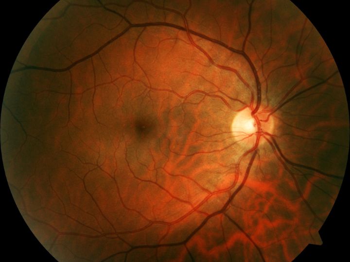 Retina Getty