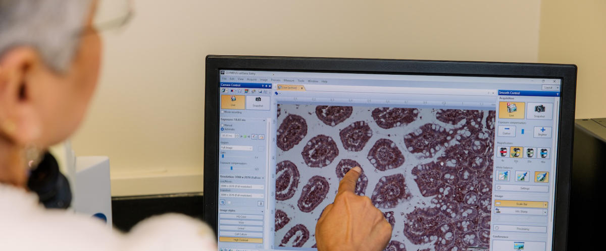 University of Houston Professor Seema Khurana points to a microscopic image showing the expression of a protein of interest in a normal tissue section. Khurana is part of a team focusing on finding treatment for Crohn’s disease.