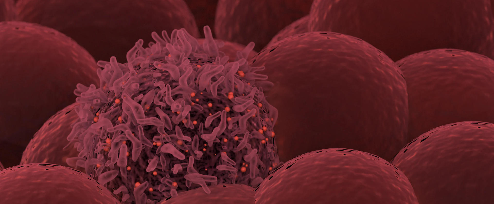 Cancer cell.